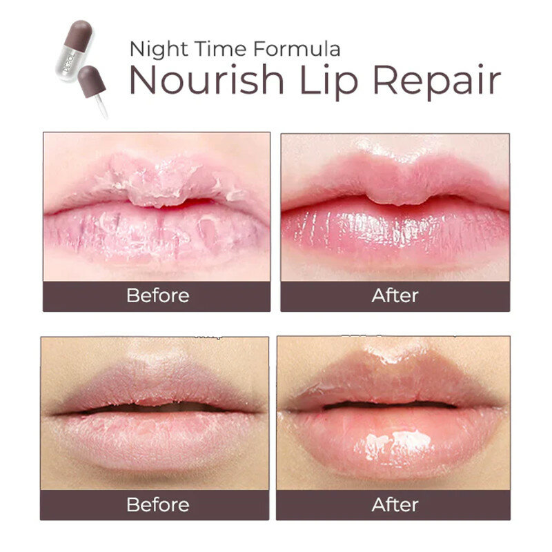 DEROL™ Lip Plumper Kit Day Night Instant Volume Lips Plumper Oil Moisturizing Repairing Reduce Lip Fine Line Serum Cosmetic