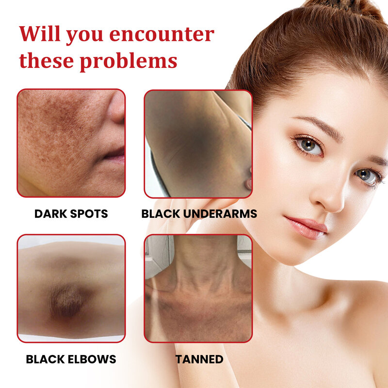 Whitening Freckles Cream Effective Remove Dark Spots Anti Fade Melanin Brighten Nourish Cream Moisturizing Brighten Skin Care