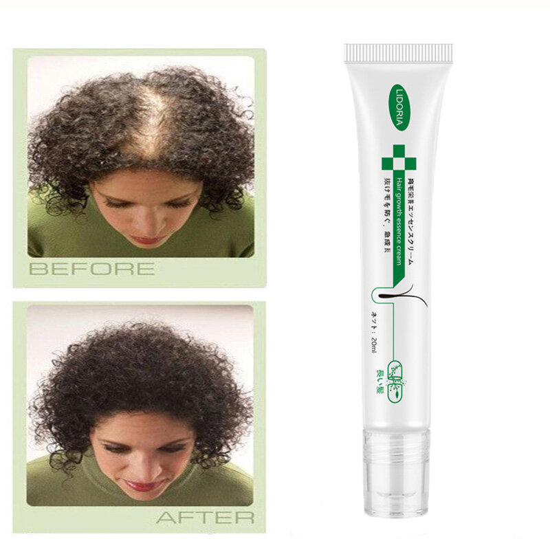 Unisex Shampoo Conditioner Anti Haarausfall Behandlung Schnelle Wachstum Serum Länger Dicker Weiches Haar Conditioner 20ml