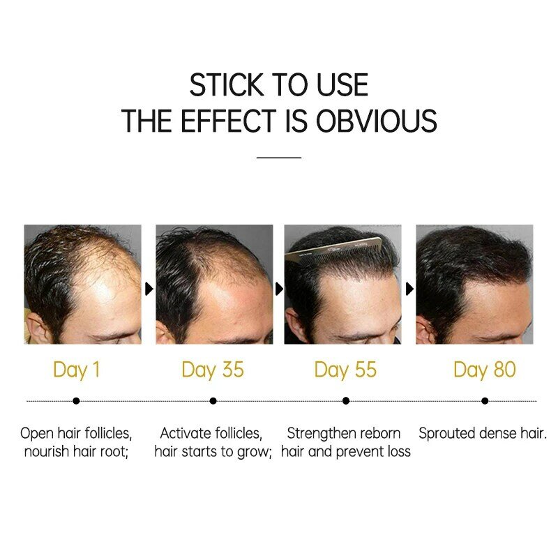 Hairinque 50Ml Vitamin B7 Produk Pertumbuhan Rambut Cepat Mencegah Rambut Rontok Serum Perawatan Kulit Kepala Minyak Perawatan Rambut Tumbuh untuk Pria Wanita