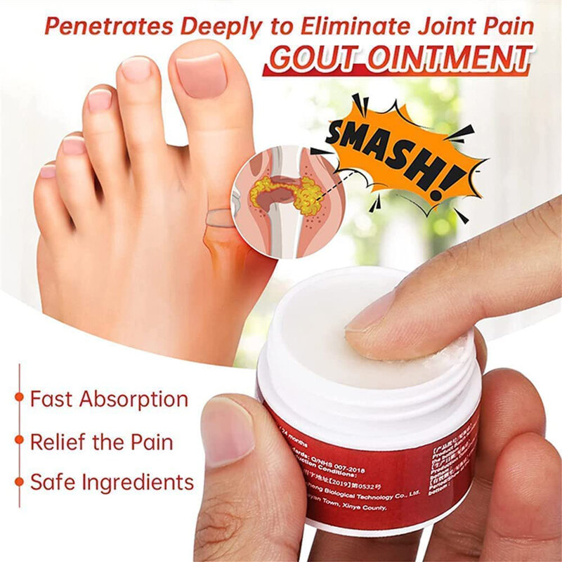 女性のためのurigoneヒーリングクリーム、外反母趾の痛みを和らげる軟膏、外反母趾の痛みを和らげます
