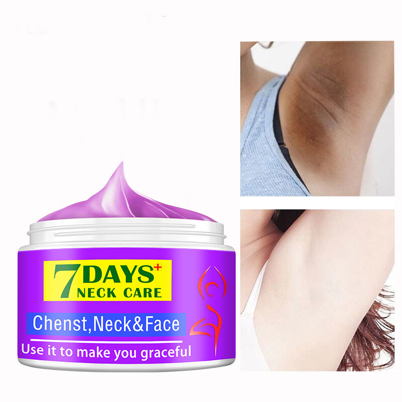 7 Hari Krim Pemutih Tubuh Ketiak Lutut Krim Titik Gelap Kulit Mencerahkan Pelembab Kosmetik Perawatan Tubuh untuk Wanita Pria