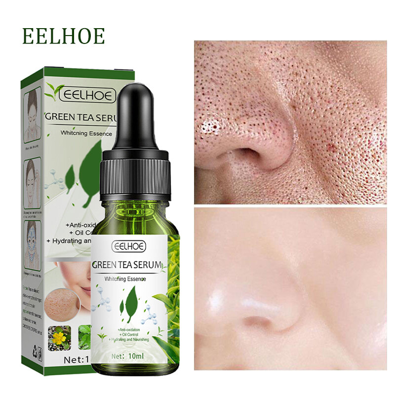 Chá verde poro encolher essência balanceamento controle de óleo reparação hidratante acne loção endurecimento redução da pele soro coreano cosméticos