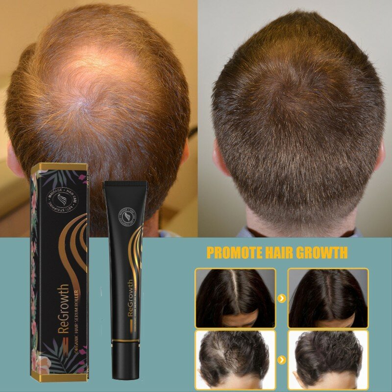 Сыворотка для роста волос 3 в 1 роликовый массажер-шарик питающий густые длинные волосы органическое эфирное масло имбирь против выпадения волос