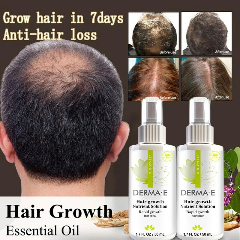 Minyak Pertumbuhan Rambut Produk Pertumbuhan Rambut Cepat Perawatan Kulit Kepala Mencegah Rambut Kering Rontok dan Menipis Perawatan Kecantikan Pria dan Wanita