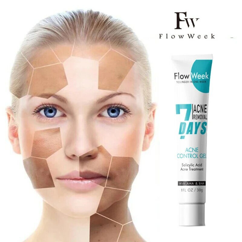 Semana de fluxo acne controle gel 30ml ácido hialurônico acne clareamento enrugamento clareamento facial delicado clareamento beleza cosméticos