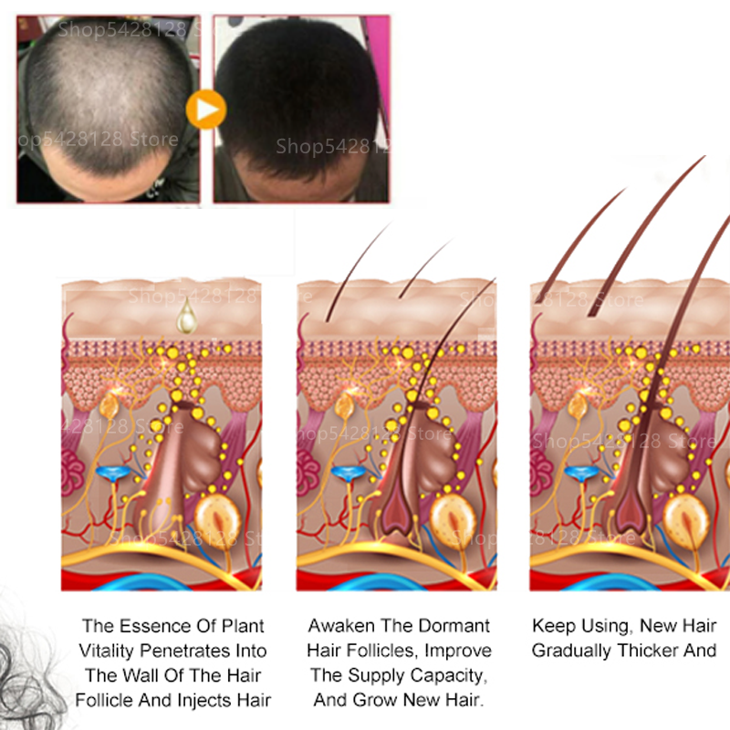 Ekstrak Tanaman Murni Jahe Sampo Anti-rambut Rontok Rambut Padat Meningkatkan Cairan Rambut Anti-jatuh Sampo Pertumbuhan Rambut Cair 400Ml