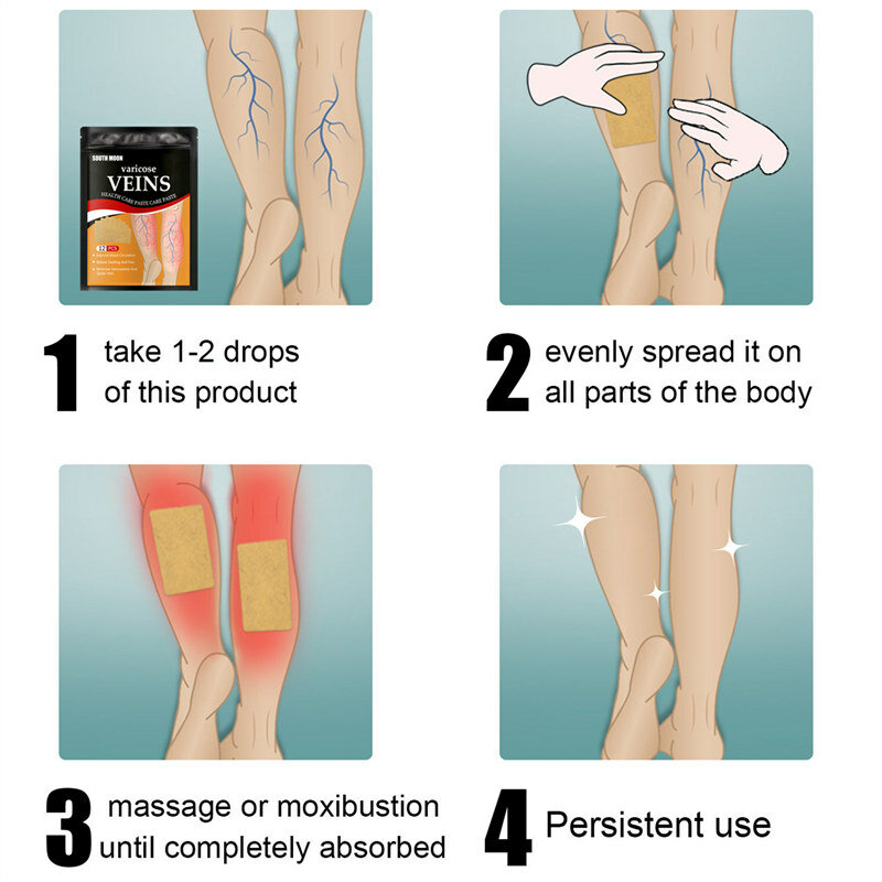 12 pezzi trattamento vene Varicose Patch dolore alle gambe gonfiore sollievo cerotto cerotto gamba Varicose impacco freddo adesivo Patch venoso
