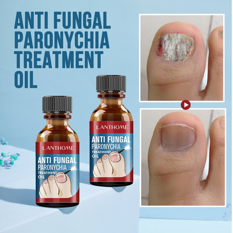 Lanthome-suero para tratamiento de hongos en las uñas, solución líquida antihongos para el cuidado de manos y pies, Gel reparador, aceite antibacteriano