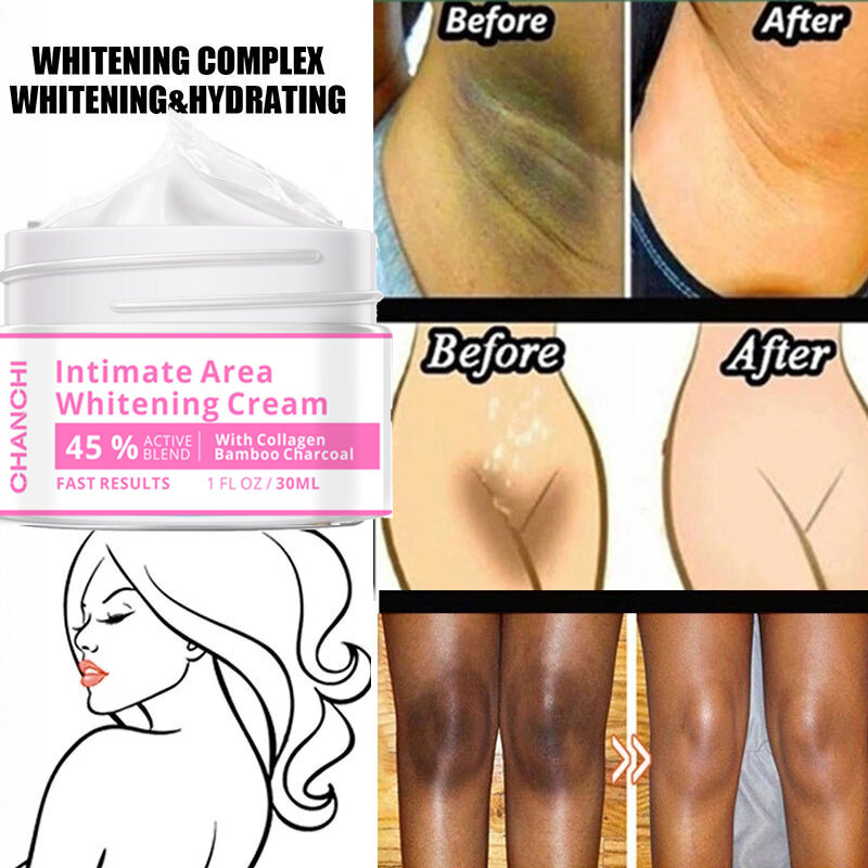Lichaam Whitening Cream Geslachtsdelen Onderarm Bleken Serum Witter Butt Knie Fleuren Innerlijke Dij Intieme Dark Verwijderen Melanine