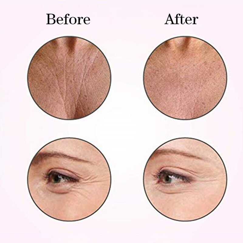 18 pçs rosto testa pescoço olho anti rugas cuidados com o envelhecimento adesivo almofada remendo reutilizável anti rugas remendos de silicone ferramenta de levantamento da pele
