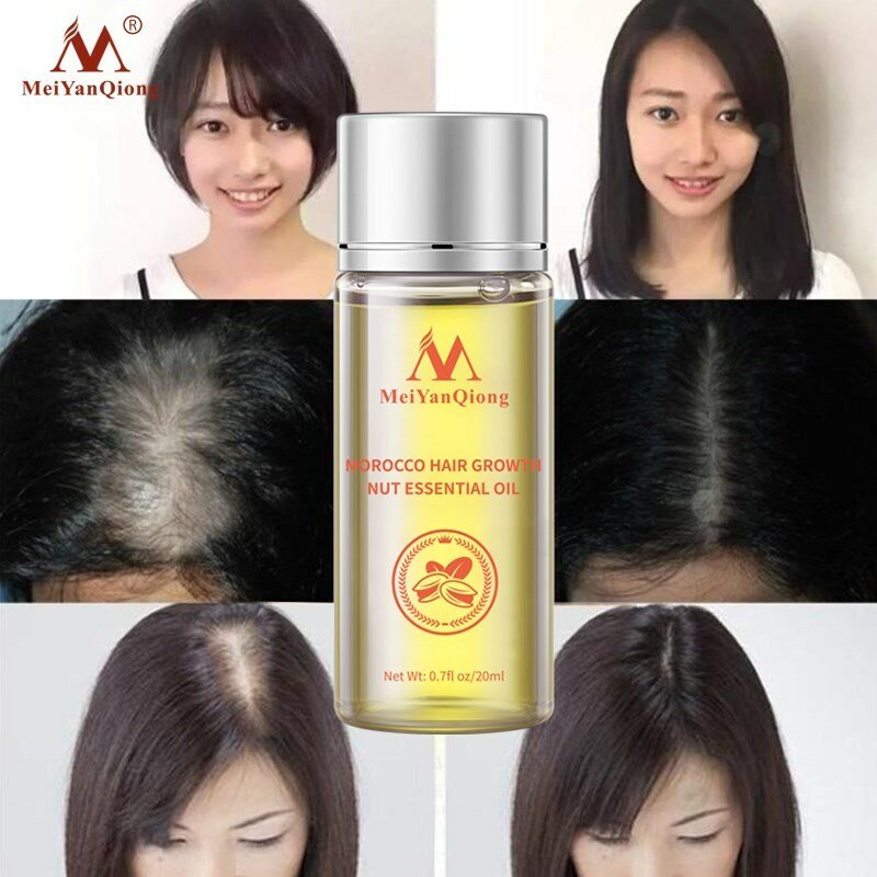 Potente olio per la crescita dei capelli prevenire i prodotti per la perdita dei capelli essenza trattamento liquido per uomini e donne riparazione Shampoo cura dei capelli 20ml