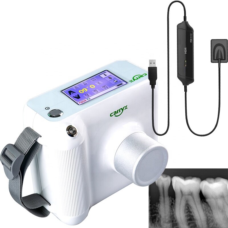 Layar Sentuh Dokter Gigi Unit Sinar X Frekuensi Tinggi Gigi Nirkabel Portabel Rontgen Gigi Digital dengan Sensor HDR500