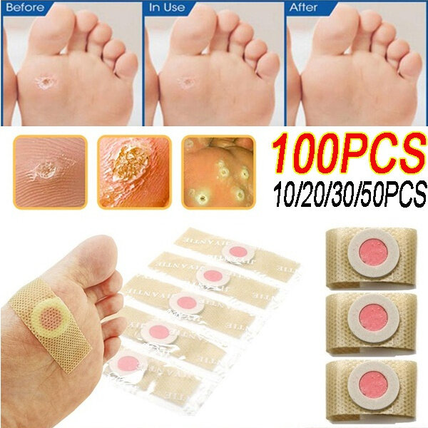 10-80PCS Medical Corn Plaster Foot Corn Removal Warts Thorn Killer Plantar Calluses Callosity Patch Detox Foot Protector Sticker