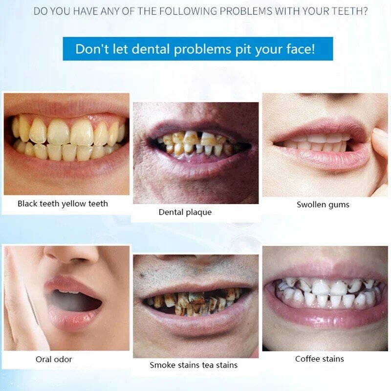 Frisse Adem Geur Verwijderen Oral Care Tandsteen Reductie Tanden Bleken Mondhygiëne Care Teeth Whitening Essentie