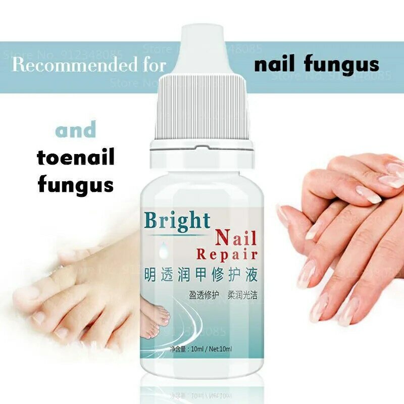Herbal Nail Fungus Treatment Cream Onychomycosis Paronychia Antifungal Nail Infection Toenail Treatment