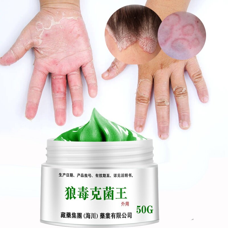 50G โรคสะเก็ดเงินโรคผิวหนัง Eczematoid กลากครีม Anti-Itch สมุนไพรจีน Medical Skin Care ครีม