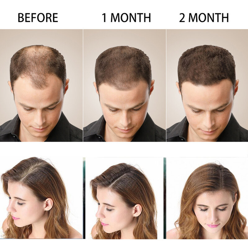 200ml natural anti-perda de cabelo shampoo crescimento mais grosso soro de tratamento de cabelo melhorar o cabelo tônico limpo couro cabeludo danificado reparação essência