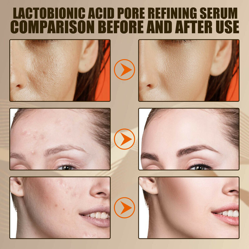 Suero reductor de poros de ácido lactobiónico, crema para blanquear la piel oscura, manchas oscuras, pecas, mejora el brillo facial, nutre la esencia