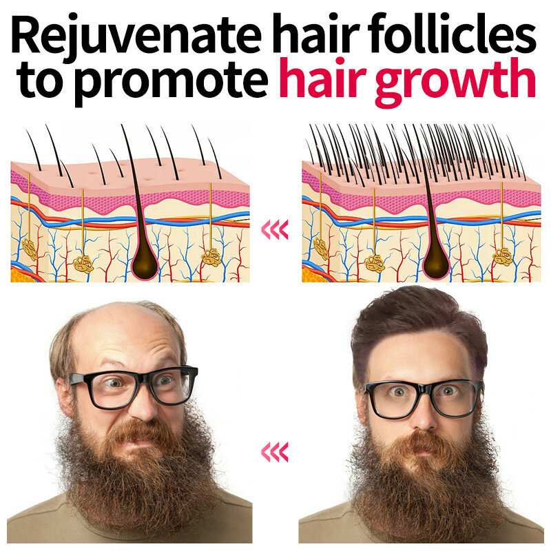 Fast Hair Growth Products Hair Regrowth Essential Oils Anti Hair Loss Treatment Scalp Effective Baldness Repair Beauty Health