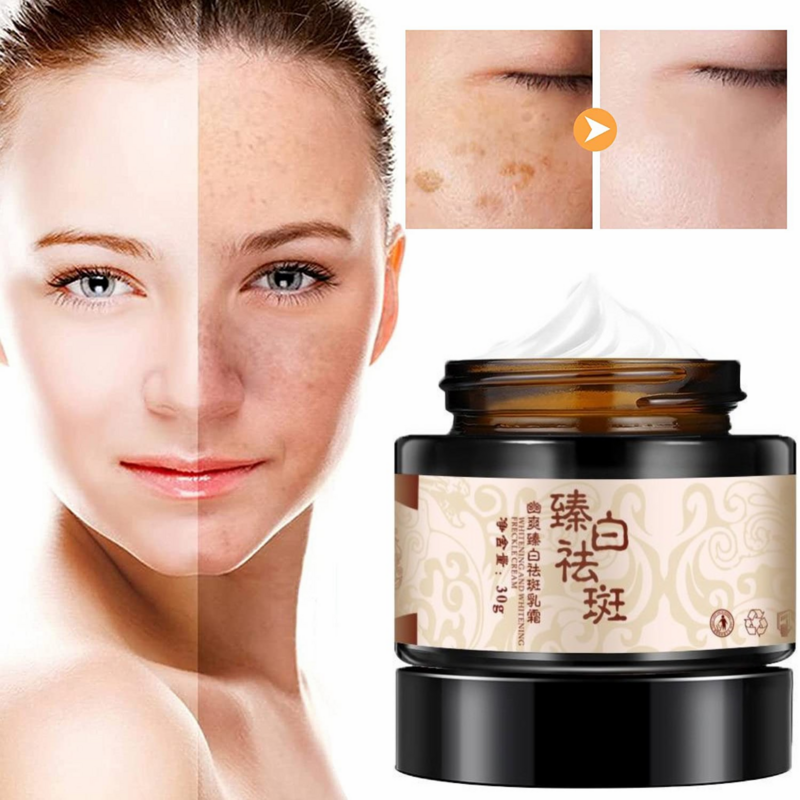 Powerful Whitening Freckle Cream Plant Face Cream Remove Dark Spots Fade Acne Scars Melanin Pigmentation Melasma Brighten Skin