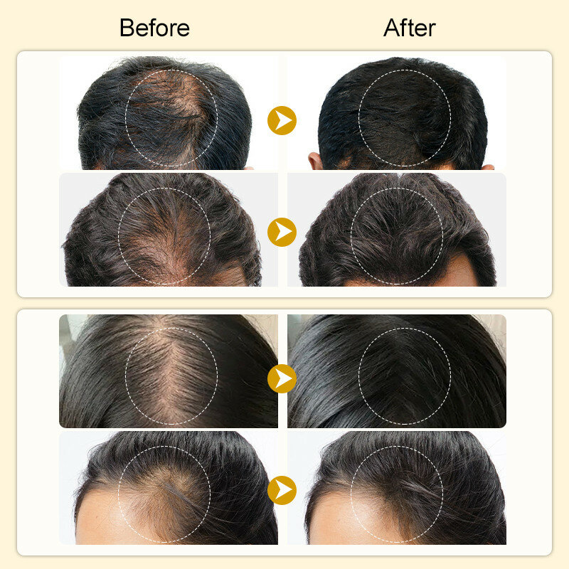 Schnelles Haar wachstum Serum Spray natürliche Anti-Haarausfall-Reparatur beschädigte Haarwurzeln starke Regeneration Kopfhaut pflege Schönheit Gesundheit