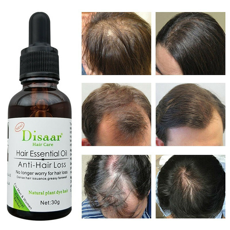 Effective Hair Growth Essence Oil Hair Fast Regrowth Serum Anti-Hair Loss Liquid Repair Treatment Follicles Dens Strong Hairline