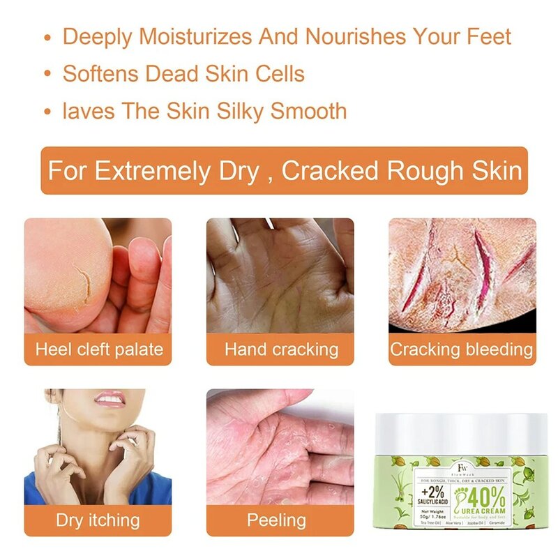 Flow Week Urea Cream 40% Plus Salicylic Acid 2% Callus Remover Hand Cream Foot Cream for Dry Cracked Feet Hands Repair Treatment