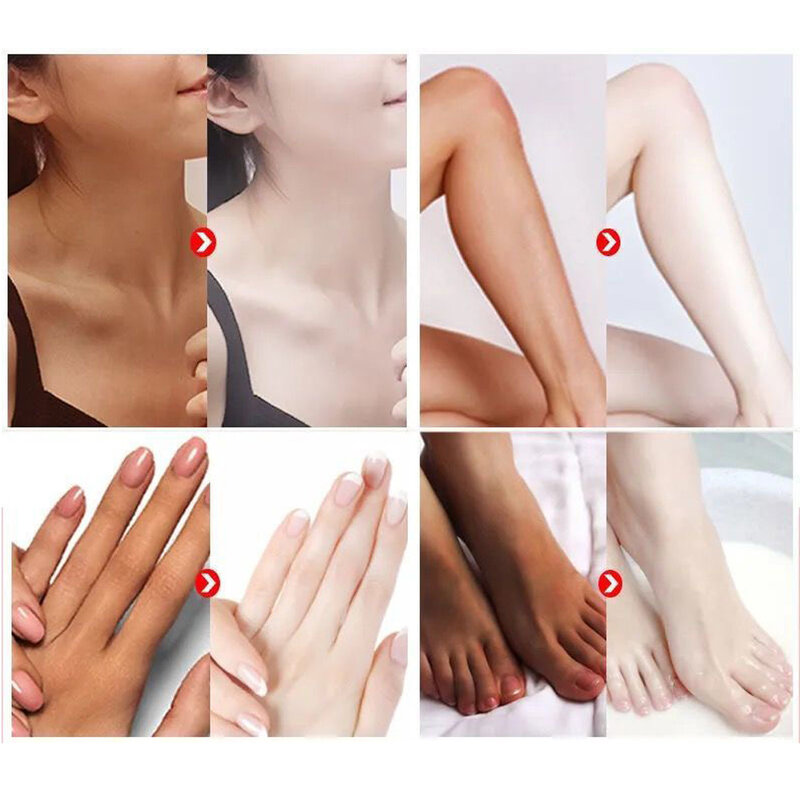 3 tage Achselhöhle Bleaching Creme Haut Aufhellung Bleichen Creme Für Unterarm Dunkle Haut Beine Knie Bleaching Intime Körper Lotion