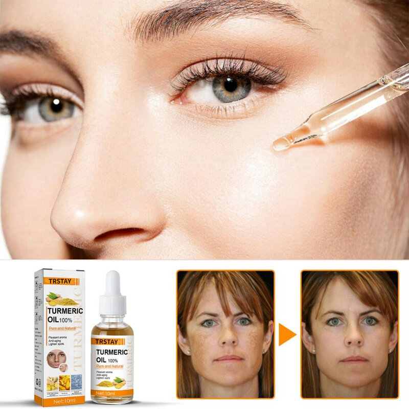 Soro de cúrcuma óleo de cuidados faciais hidratante hidratante clarear rosto soro anti-envelhecimento remoção pigmento melanina rosto pele