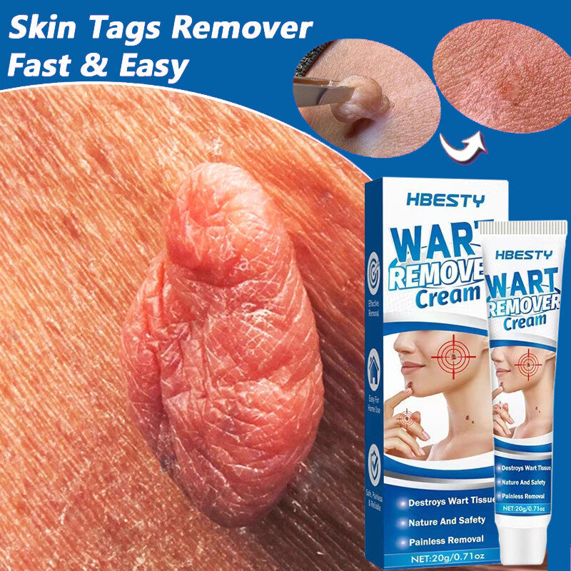 3Pcs Skin Tag Remover ครีม Wart Treatment ไม่เจ็บปวด Mole Remover เซรั่ม Dark Spot ข้าวโพด Wart Freckle Antibacterial ครีม