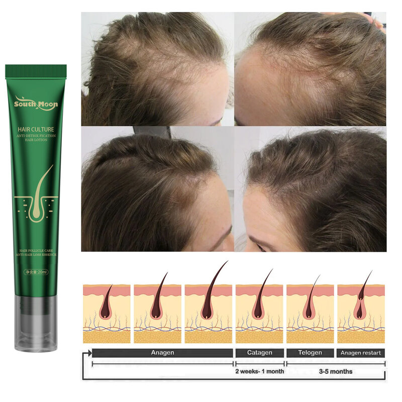 20ml gengibre crescimento do cabelo essência bola de rolamento massagem soro do cabelo rolo-no soro do crescimento do cabelo anti queda de cabelo rápido crescer o óleo do cabelo
