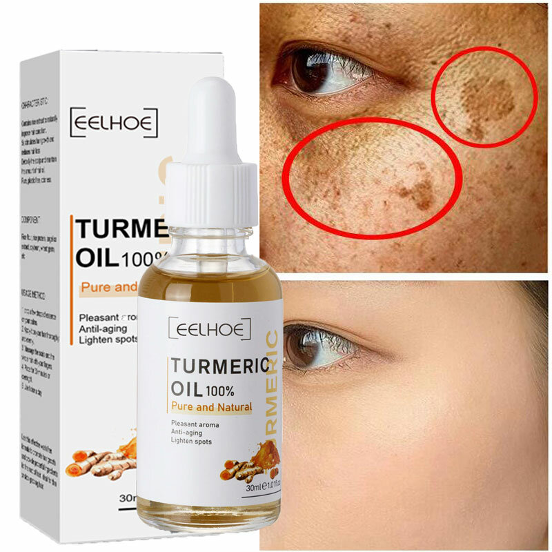 Kup 1 dostać 2 kurkuma Freckle Serum wybielające olej kurkumina rozjaśnić znikną ciemna plama usuwanie melaniny twarzy krem rozjaśniający skórę
