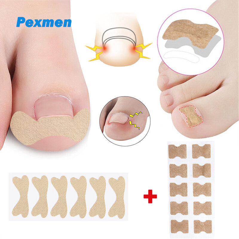 Pexmen 16Pcs Toenail Corrector Patch adesivi per la correzione dell'unghia del piede incarnita salute senza colla strumento per la cura dei piedi