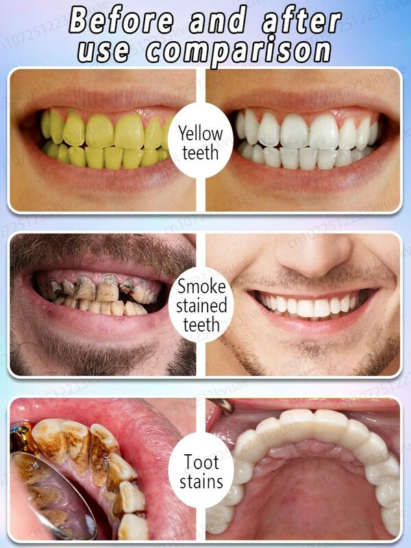 مكافحة تجويف تسوس الأسنان الطازجة رائحة الفم الكريهة إصلاح تسوس الأسنان إزالة البلاك وجع الأسنان تخفيف التهاب اللثة