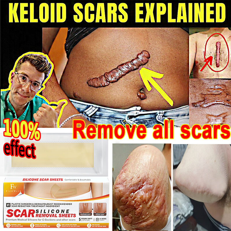 Hoja de cicatrices para eliminar cicatrices, hiperplasia, keloides, quemadura, tratamiento de cicatriz quirúrgica, reparación eficiente de la piel dañada, crema de arrugas del embarazo