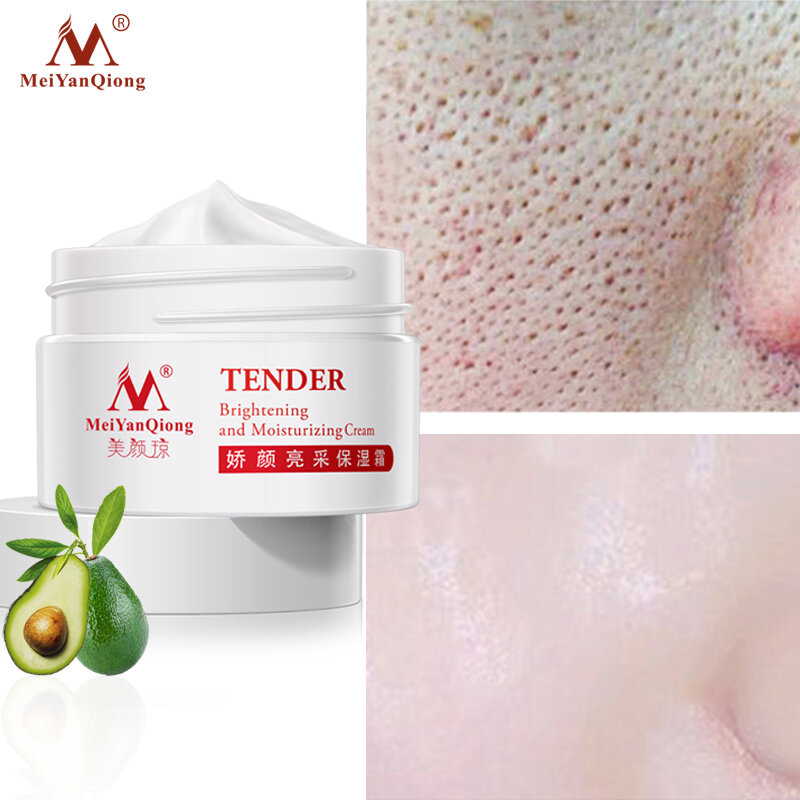 ครีมรูขุมขน Skin Care Face Lift Essence Tender Anti-Aging Whitening Wrinkle Removal Face ครีม Hyaluronic Acid