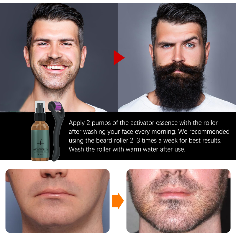 Kit de rouleaux de croissance de barbe pour hommes, essence de croissance de barbe pour hommes, rehausseur nourrissant, huile de barbe, spray de soin, 30ml