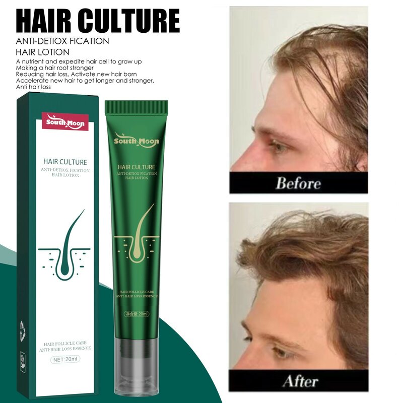 2023 Biotin Schnelle Haar Wachstum Öl Nachwachsen Der Haare Serum Haarausfall Behandlung Haar Wachstum Flüssigkeit Anti Haarausfall Frauen Männer gesundheit