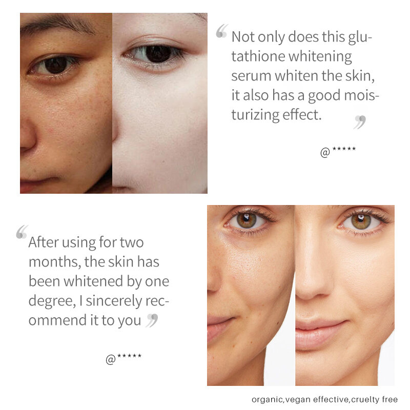 Original Lanthome Glutathione Whitening Serum Fade Black Dark Spots Defects Reduce Facial Oil Brightening Firming For Women
