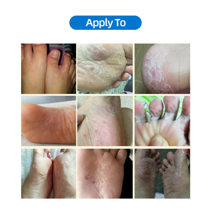 Herbal Athletes Foot Spray Anti-fungal Deodorant Foot Antibacterial Itching Bacteriostatic Feet Odor Powder Liquid Spray 55ML