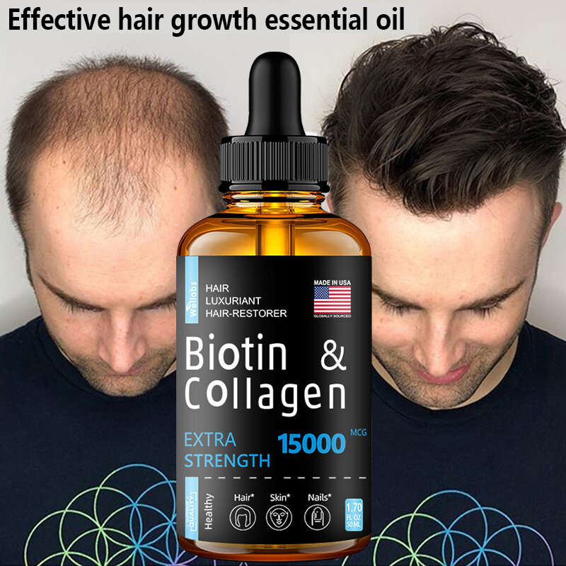 Hair Growth Products Ginger Essence Fast Regrowth Serum Beard Growth Oil Hair Loss Care Beauty Scalp Treatment For Men Women