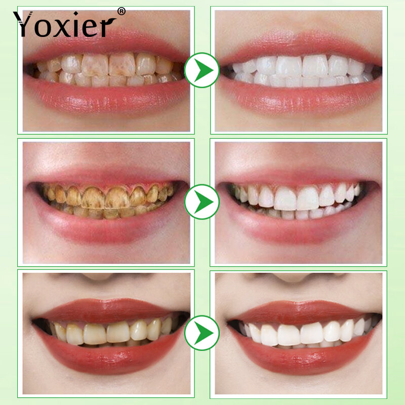 Dentes branqueamento essência lixívia dentes líquido remover manchas de fumaça manchas de café boca higiene melhorar oral odor dental ferramenta cuidados