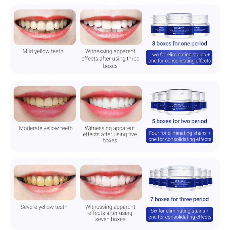 Dentes branqueamento em pó dentes limpos dentes dentífrico remover manchas de placa dental mau hálito fresco por via oral ferramentas cuidados 30g
