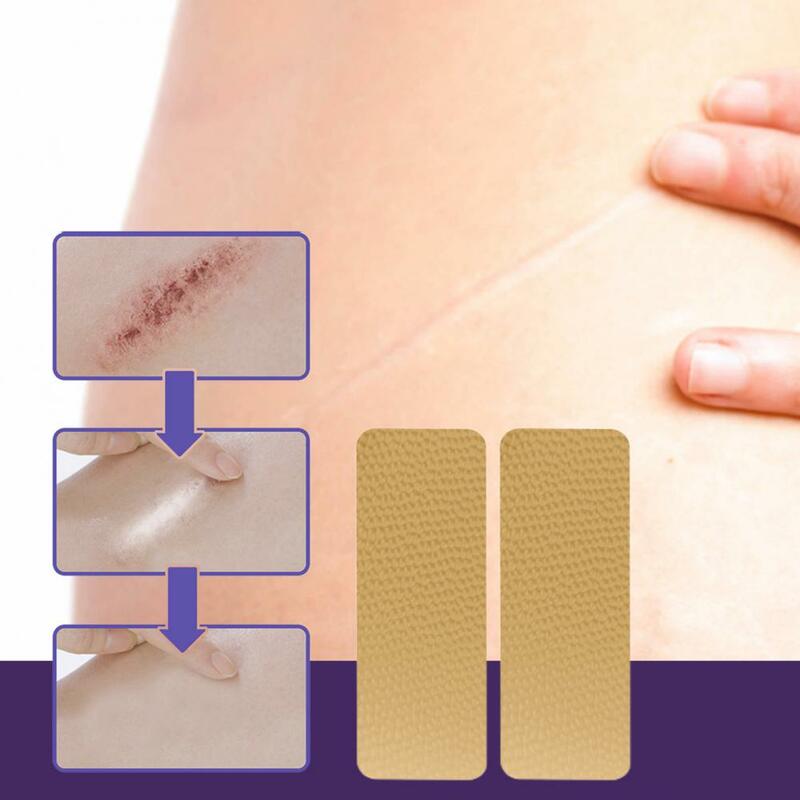8Pcs/Box Functional No Odor Waterproof Acne Scar Removal Skin Repair Sheet for Hands Scar Repair Patch Scar Repair Decal