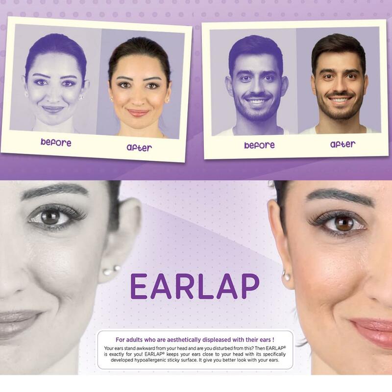 Sistema de colagem do efeito imediato do corretivo da orelha do earlap das fitas da beleza para as orelhas salientes, fitas da colagem da orelha