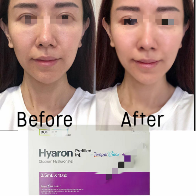 2022 جديد Korae 2.5 مللي قطعة Hyaron الوجه BB Bream للوجه العمر المضادة للتجاعيد زيادة الكولاجين إنتاج الوجه رفع BB كريم
