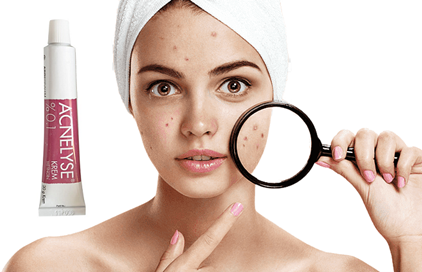 Acnelyse 0.1 (2 Stuks) acne Behandeling Fijne Rimpels En Gezicht Schade Pukkels En Puistjes Maximale Sterkte Met Tretinoin Tretin