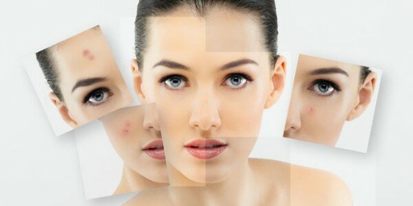 Expigment Hydroquinone 4 Cream For Skin Bleaching Skin Lightening Skin Melasma Treatment 30g/1oz