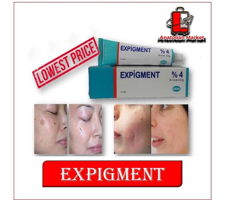 Expigment 4% crema idrochinone sbiancamento della pelle rimozione di punti neri trattamento schiarente Melasma | Originale | Spedizione veloce